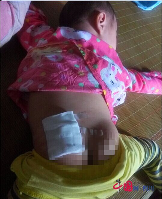 蓬溪1歲孩子不幸患上白血病 高昂醫療費用急需幫助